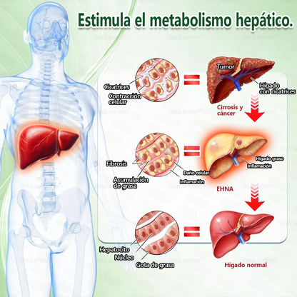 𝐈𝐧𝐬𝐋𝐞𝐦𝐨𝐧® 𝗠𝗼𝗿𝗶𝗻𝗴𝗮 × 𝗕𝗲𝗿𝗯𝗲𝗿𝗶𝗻𝗮 × 𝗔𝗠𝗣𝗞 𝟭𝟬-𝗶𝗻-𝟭 𝗣𝗮𝗿𝗰𝗵𝗲 𝗠𝗲𝘁𝗮𝗯𝗼𝗹𝗶𝗰𝗼 𝗱𝗲 𝗡𝗮𝗻𝗼 𝗠𝗶𝗰𝗿𝗼𝗮𝗴𝗵𝗮 (🇪 Solo una vez al día, cambios visibles en 7 días) ✅ Para sobrepeso, diabetes, apnea del sueño, problemas articulares y más